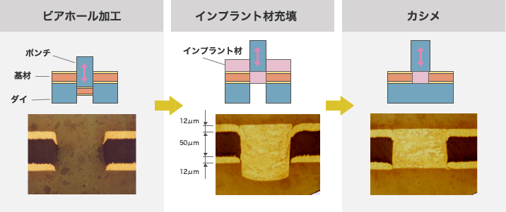 ビアホール加工、インプラント材充填、カシメ